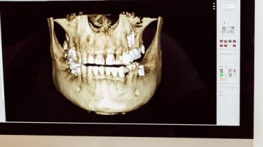 Funding Options for Dental Practices | LendGenius